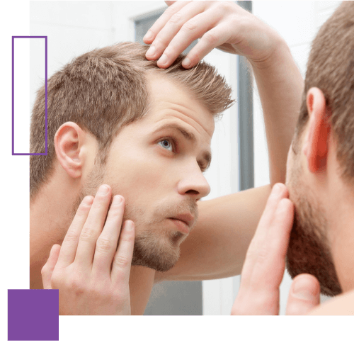 Procedimiento de injerto capilar disponible a través de Medrism en España