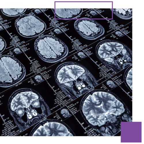 Servicios de neurología avanzada ofrecidos por Medrism en hospitales españoles