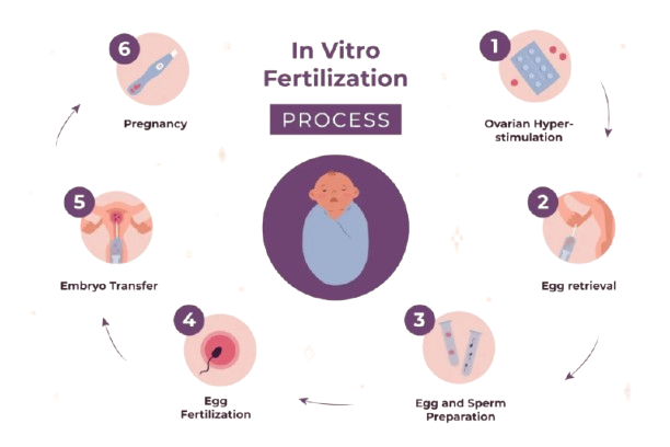 Representación visual del proceso de fertilización in vitro (FIV) en clínicas españolas