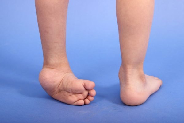 Deformidades-del-pie-y-del-tobillo