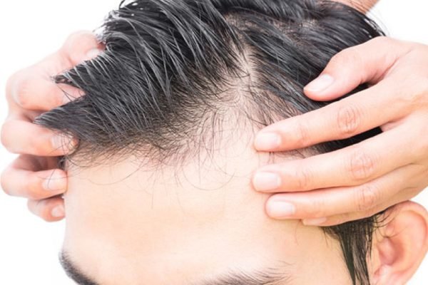 Tecnica-FUSS-Follicular-Unit-Strip-Surgery