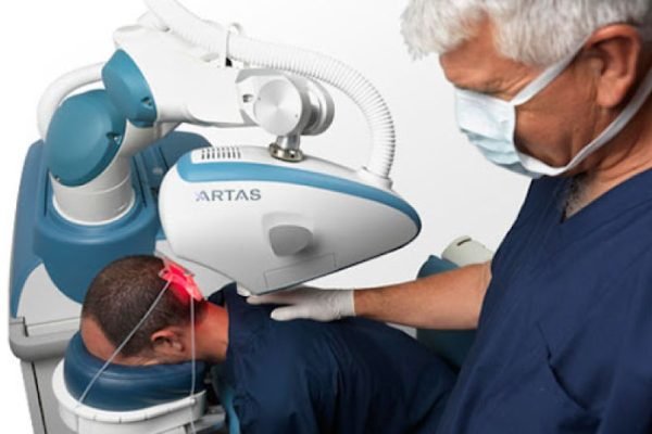Trasplante-de-pelo-con-robot-ARTAS-convencional