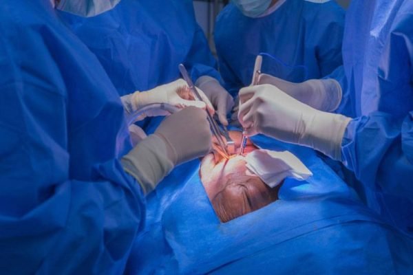 cirugia-por-insuficiencia-cardiaca